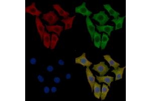 Cytochrome P450 2W1 Mouse Monoclonal Antibody staining Hela cells by IF/ICC.