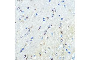 Immunohistochemistry of paraffin-embedded mouse brain using FUT4 Rabbit pAb (ABIN7267274) at dilution of 1:100 (40x lens). (CD15 anticorps  (AA 200-300))