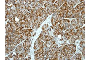 IHC-P Image Immunohistochemical analysis of paraffin-embedded SW480 xenograft, using MP1, antibody at 1:500 dilution. (MAPKSP1 anticorps)