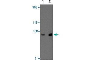 Western blot analysis of MEX3D in MDA-MB-361 cell lysate with MEX3D polyclonal antibody  at (Lane 1) 1 ug/mL and (Lane 2) 2 ug/mL .