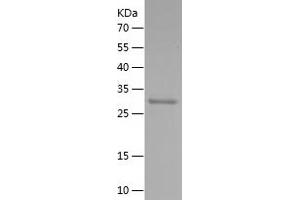 Western Blotting (WB) image for Solute Carrier Family 34 (Sodium Phosphate), Member 2 (SLC34A2) (AA 1-100) protein (His-IF2DI Tag) (ABIN7125165)