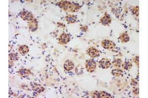 Formalin-fixed and paraffin embedded human kidney labeled with Anti-PBEF1 Polyclonal Antibody, Unconjugated  at 1:200 followed by conjugation to the secondary antibody and DAB staining. (NAMPT anticorps  (AA 301-400))