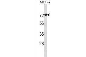 AGAP11 antibody  (N-Term)