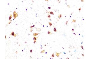 Immunohistochemistry of paraffin-embedded mouse spinal cord using Casein Kinase 2 beta (CSNK2B) (CSNK2B) Rabbit mAb (ABIN1680593, ABIN3019007, ABIN3019008 and ABIN7101698) at dilution of 1:100 (40x lens).