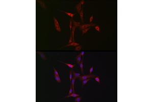 Immunofluorescence analysis of NIH/3T3 cells using NBR1 Rabbit pAb (ABIN1680974, ABIN3018329 and ABIN3018330) at dilution of 1:50 (40x lens).
