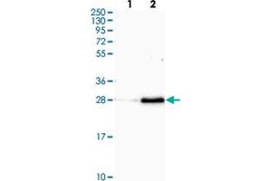 Western blot analysis of Lane 1: Human cell line RT-4 Lane 2: Human cell line U-251MG sp with OIP5 polyclonal antibody  at 1:100-1:250 dilution. (OIP5 anticorps)