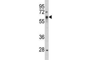Western blot analysis of Src antibody and HepG2 lysate.