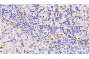 Detection of ALB in Rat Ovary Tissue using Polyclonal Antibody to Albumin (ALB)