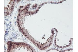 Immunohistochemistry (IHC) image for anti-Interferon Regulatory Factor 6 (IRF6) antibody (ABIN1498901)