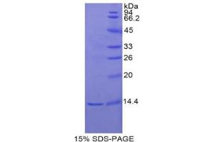 SDS-PAGE analysis of Rat Inhibin beta E Protein. (INHBE Protéine)