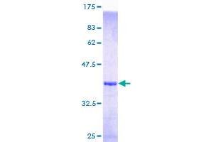 Image no. 1 for MEF2B Neighbor (MEF2BNB) (AA 1-119) protein (GST tag) (ABIN2752857)
