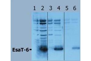 Western Blotting (Mycobacterium Tuberculosis Antigen EsaT-6 (Rv3875) anticorps)