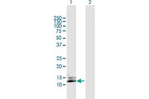 Western Blot analysis of SIVA1 expression in transfected 293T cell line by SIVA1 MaxPab polyclonal antibody. (SIVA1 anticorps  (AA 1-110))