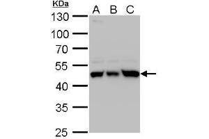 WB Image UQCRC1 antibody detects UQCRC1 protein by western blot analysis.