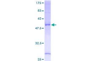 Image no. 1 for Steroid-5-alpha-Reductase, alpha Polypeptide 1 (3-Oxo-5 alpha-Steroid delta 4-Dehydrogenase alpha 1) (SRD5A1) (AA 1-259) protein (GST tag) (ABIN1321300)