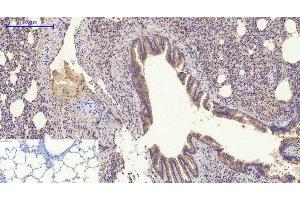 Immunohistochemistry of paraffin-embedded Rat lung tissue using GLUT-4 Polyclonal Antibody at dilution of 1:200. (GLUT4 anticorps)