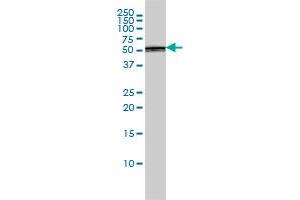 PTBP1 monoclonal antibody (M01), clone 3H8 Western Blot analysis of PTBP1 expression in A-431 .