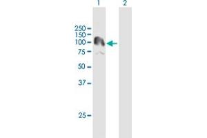 Western Blot analysis of PKN3 expression in transfected 293T cell line by PKN3 MaxPab polyclonal antibody. (PKN3 anticorps  (AA 1-889))