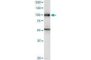 DAB2 MaxPab polyclonal antibody.