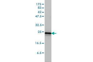 RRAS2 monoclonal antibody (M01), clone 2D3-4B8 Western Blot analysis of RRAS2 expression in A-431 .