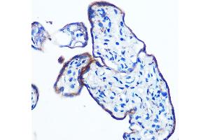 Immunohistochemistry of paraffin-embedded human placenta using IKKε Rabbit mAb (ABIN7267875) at dilution of 1:100 (40x lens). (IKKi/IKKe anticorps)