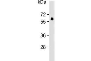 Western blot testing of human lung lysate with SMAD6 antibody. (SMAD6 anticorps  (AA 358-386))