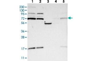 Western blot analysis of Lane 1: RT-4, Lane 2: U-251 MG, Lane 3: Human Plasma, Lane 4: Liver, Lane 5: Tonsil with KLHL6 polyclonal antibody . (KLHL6 anticorps)