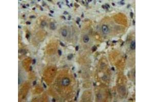 Used in DAB staining on fromalin fixed paraffin-embedded Liver tissue (DGKG anticorps  (AA 451-698))