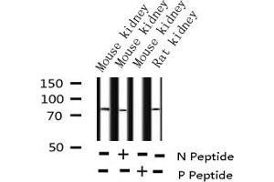 Western blot analysis of Phospho-C-RAF (Ser338) expression in various lysates (RAF1 anticorps  (pSer338))