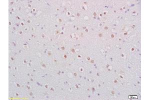 Formalin-fixed and paraffin embedded rat brain labeled with Anti-BDNF Polyclonal Antibody, Unconjugated (ABIN1387788) at 1:200 followed by conjugation to the secondary antibody and DAB staining.