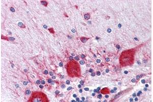 Human Brain, Cerebellum: Formalin-Fixed, Paraffin-Embedded (FFPE)