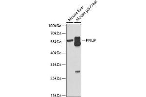Western blot analysis of extracts of various cell lines, using PNLIP antibody (ABIN6128521, ABIN6145838, ABIN6145840 and ABIN6222025) at 1:1000 dilution.