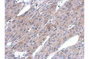 IHC-P Image Immunohistochemical analysis of paraffin-embedded U87 xenograft, using ASL, antibody at 1:500 dilution.
