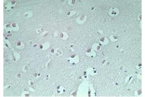 Image no. 1 for anti-Microtubule-Associated Protein 1 Light Chain 3 alpha (MAP1LC3A) (AA 1-50) antibody (ABIN207748)