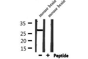 Western blot analysis of extracts from mouse brain, using OAZ3 Antibody. (OAZ3 anticorps  (Internal Region))