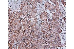 IHC analysis of HSPH1 using anti-HSPH1 antibody (ABIN7602237). (HSPH1 anticorps  (AA 653-858))