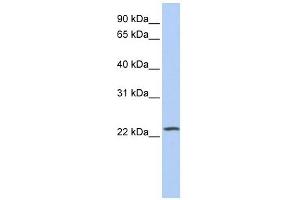 PIP5KL1 antibody used at 1 ug/ml to detect target protein.