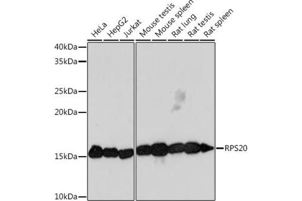 RPS20 anticorps