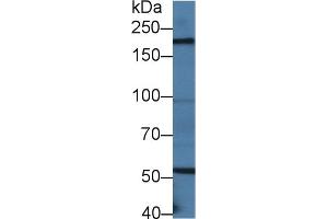 Detection of LAMb2 in Mouse Small intestine lysate using Polyclonal Antibody to Laminin Beta 2 (LAMb2) (LAMB2 anticorps  (AA 1498-1716))