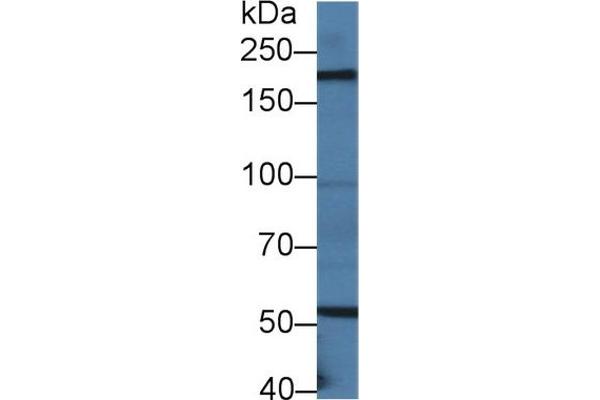 LAMB2 anticorps  (AA 1498-1716)