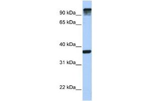 WB Suggested Anti-EPS15  Antibody Titration: 0. (EPS15 anticorps  (C-Term))