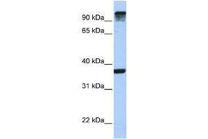 WB Suggested Anti-EPS15  Antibody Titration: 0. (EPS15 anticorps  (C-Term))