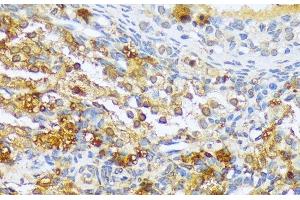 Immunohistochemistry of paraffin-embedded Rat ovary using A1CF Polyclonal Antibody at dilution of 1:100 (40x lens). (A1CF anticorps)