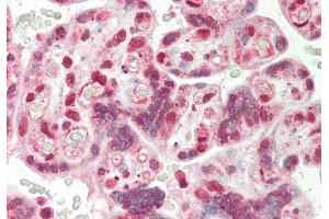 Rabbit Anti-CBX3 antibody  Formalin Fixed Paraffin Embedded Tissue: Human Placenta Primary antibody Concentration: 1:100 Secondary Antibody: Donkey anti-Rabbit-Cy3 Secondary Antibody Concentration: 1:200 Magnification: 20x Exposure Time: 0. (CBX3 anticorps  (Middle Region))
