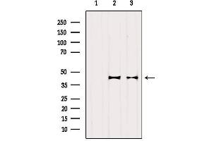 Western blot analysis of extracts from various samples, using OXA1L Antibody. (OXA1L anticorps  (C-Term))