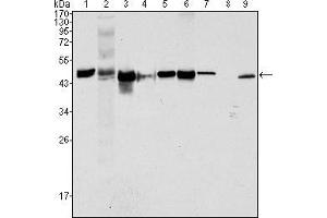 Western blot analysis using CK18 mouse mAb against Hela (1), NIH/3T3 (2), A549 (3), Jurkat (4), MCF-7(5), HepG2 (6), A431 (7), HEK293 (8) and K562 (9) cell lysate. (Cytokeratin 18 anticorps  (AA 391-483))