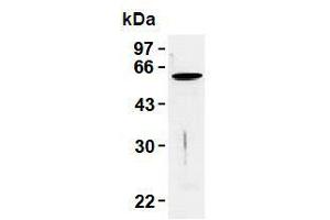 Western Blotting (WB) image for anti-Vimentin (VIM) antibody (ABIN1109486) (Vimentin anticorps)