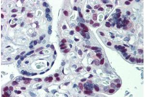 Human Placenta: Formalin-Fixed, Paraffin-Embedded (FFPE)