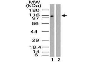 Western blot analysis of Importin-9 in HeLa lysate in the 1) absence and 2) presence of immunizing peptide. (Importin 9 anticorps  (AA 950-1000))