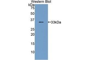Detection of Recombinant BST1, Mouse using Polyclonal Antibody to Bone Marrow Stromal Cell Antigen 1 (BST1) (BST1 anticorps  (AA 28-282))
